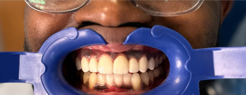 Welcome to HD Smile Modern Dentistry Welcome to HD Smile Modern Dentistry