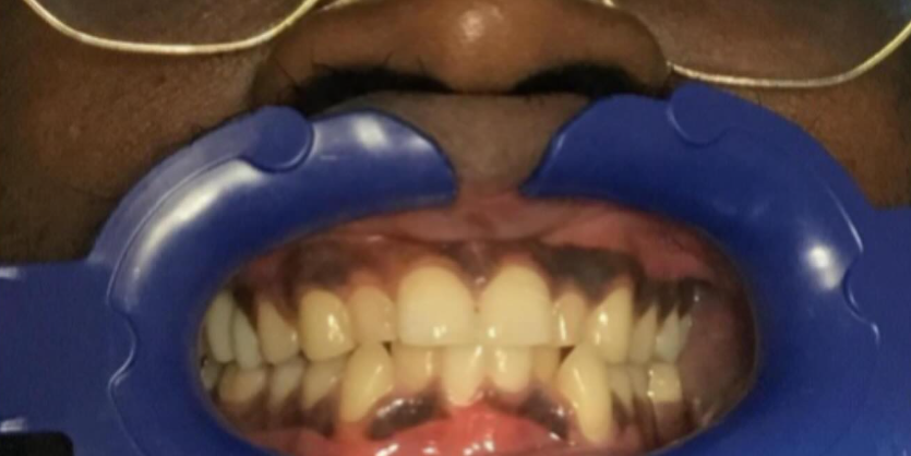 Welcome to HD Smile Modern Dentistry Welcome to HD Smile Modern Dentistry