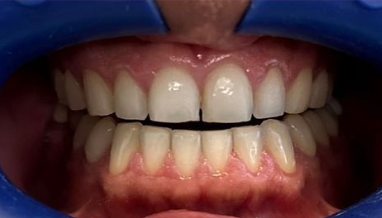 Welcome to HD Smile Modern Dentistry Welcome to HD Smile Modern Dentistry